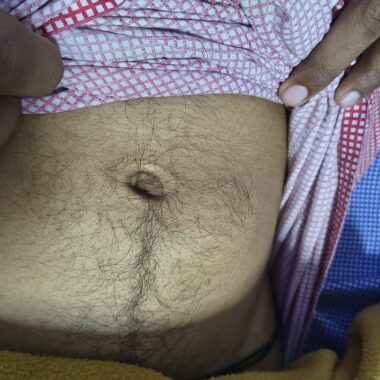 insulin1