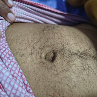 insulin2